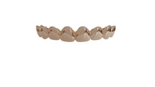Load image into Gallery viewer, Yellow Gold Solid Gold Grillz