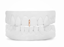 Load image into Gallery viewer, Gold Spacer Grill