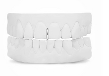 Load image into Gallery viewer, Gold Spacer Grill