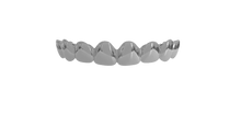 Load image into Gallery viewer, Solid Silver Grillz
