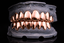 Load image into Gallery viewer, Gold Grillz