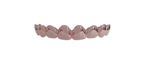 Rose Gold Solid Gold Grillz