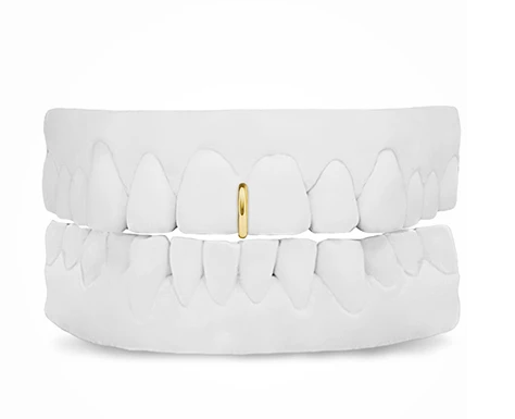 Gold Spacer Grill