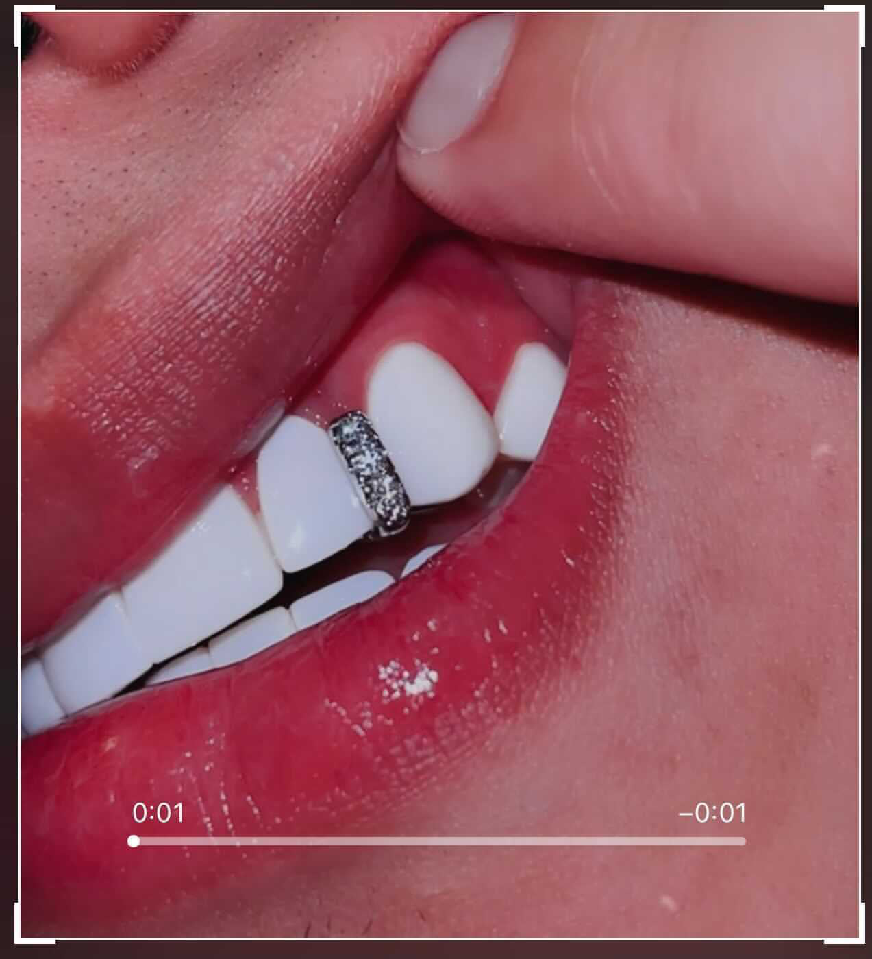 Diamond Tooth