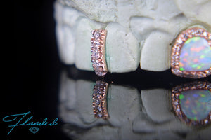 Diamond Encrusted Opal Grill with Diamond Spacer & Solid Cap